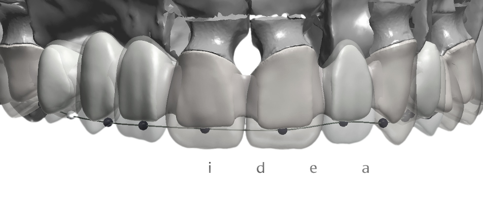 idea